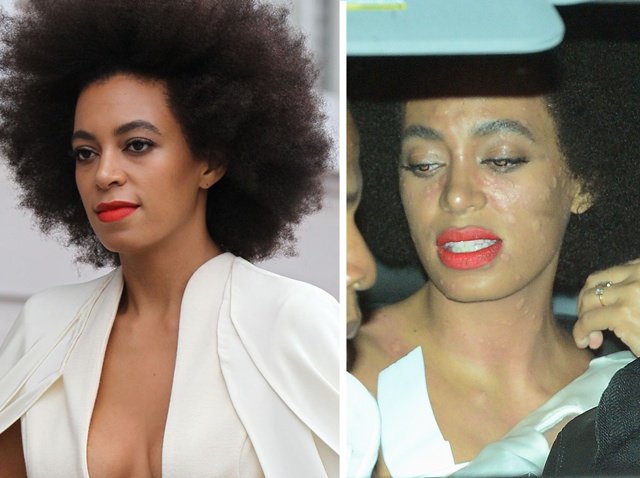 Solange Knowles Suffers With Hives On Her Wedding Day