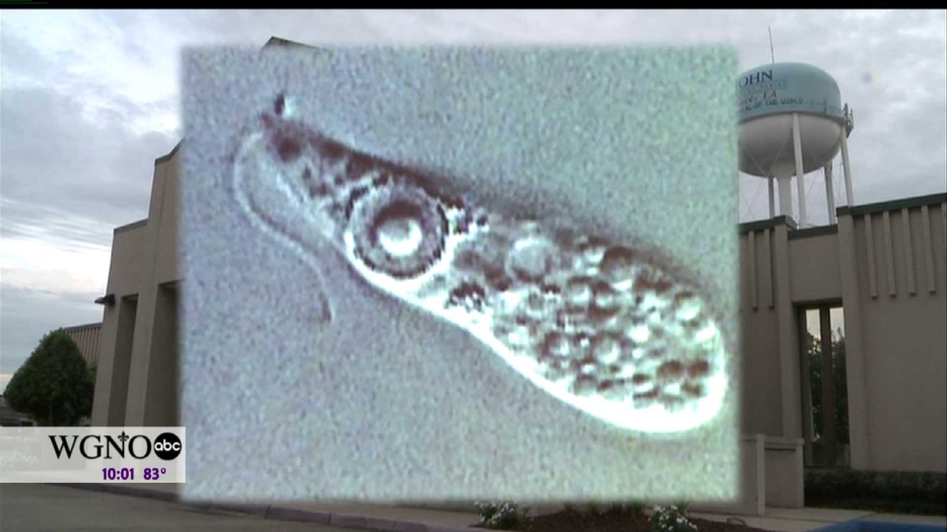 Deadly, braineating amoeba found in Louisiana water system AOL News