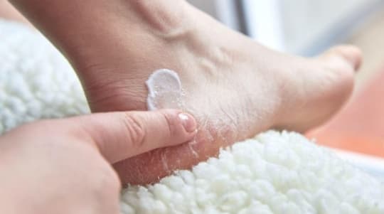 This $6 foot cream makes severely cracked heels soft
