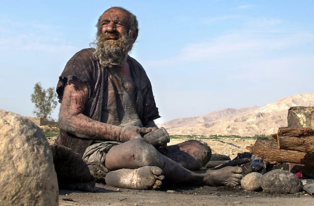 'World's Dirtiest Man' dead at 94 'not long after' 1st bath in 60 years