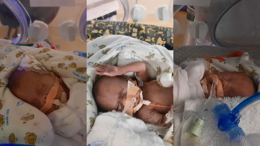 How 5 cops helped a mom deliver triplets on a Colorado porch