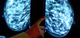 Health watchdog backs wider use of breast cancer tumour profiling tests