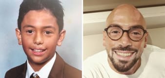Man wore make-up for 16 years to hide vitiligo