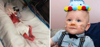 1lb baby beats odds to celebrate first birthday