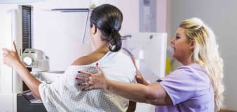Mammograms should begin at age 40, USPSTF says